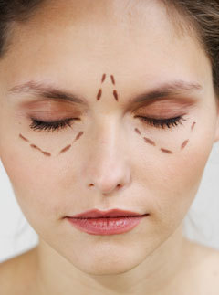 Marie Claire news: Woman marked for plastic surgery