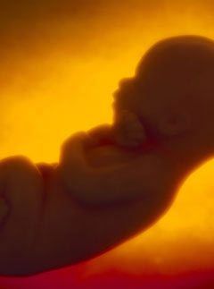 Foetus