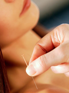 Marie Claire health news: Acupuncture