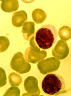cancer cell