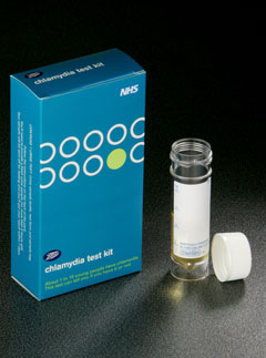 Chlamydia test, health news, Marie Claire