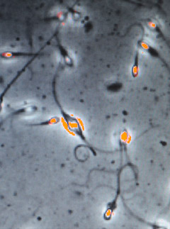 A new test that checks a man's sperm count will soon be available in the UK
