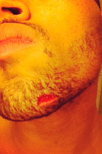 Chris Brown - Chris Brown Injury - Chris Brown Fight - Chris Brown Bottled - Marie Claire - Marie Claire UK